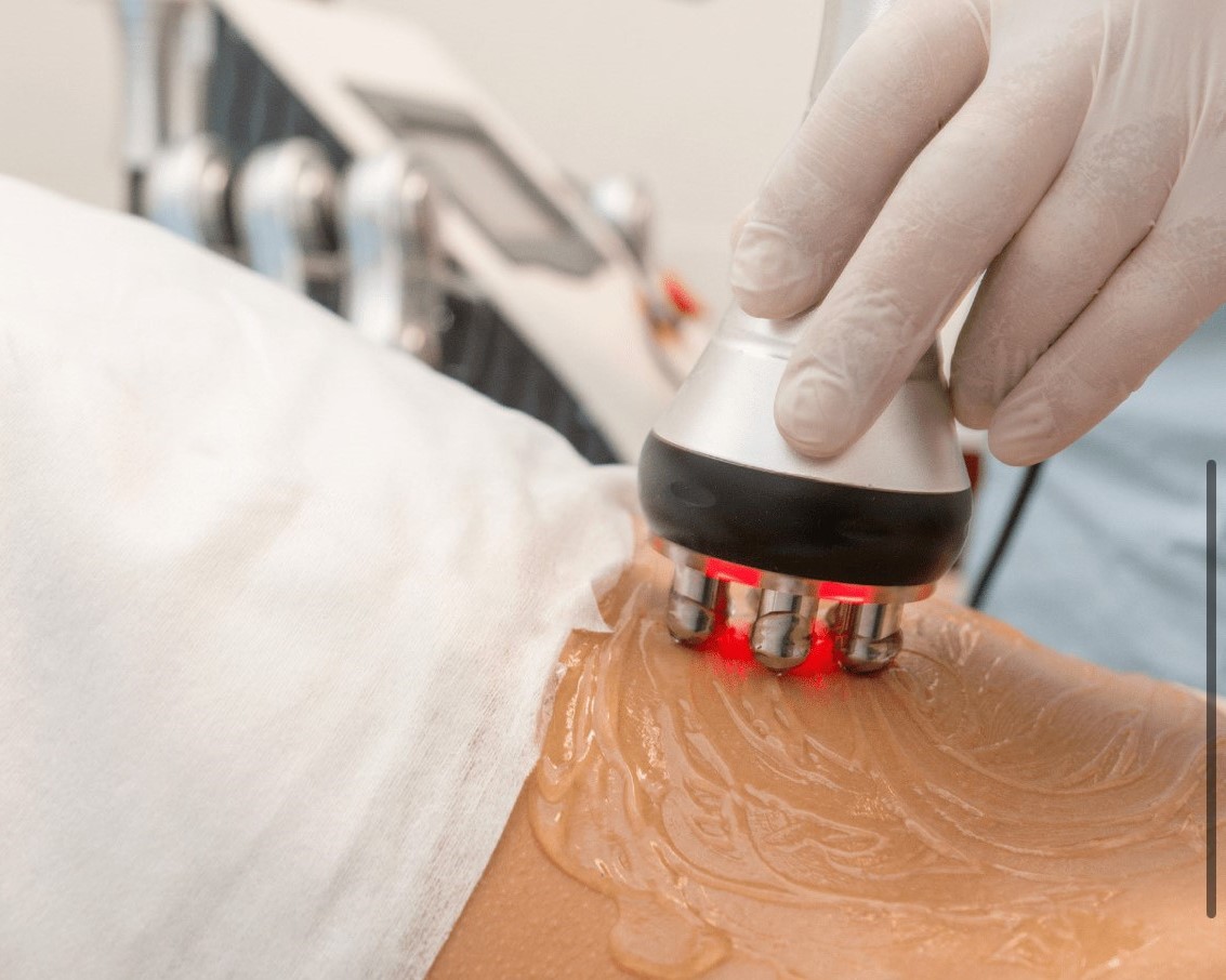 Radiofrecuencia en Adrogué